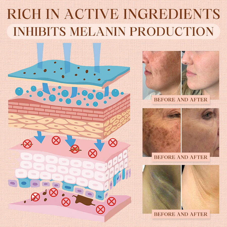Luhaka® Purifying Exfoliating Gel for Acanthosis Nigricans, Exfoliation, Dark Spots, Skin Tags, and Eczema